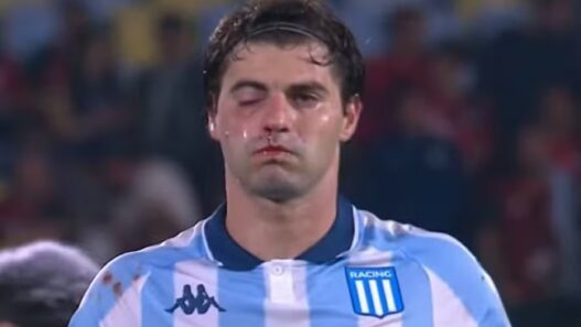 Sosa, do Racing, se entrega em campo e acaba no hospital após trauma facial, veja seus números