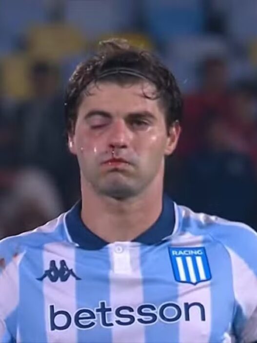Sosa, do Racing, se entrega em campo e acaba no hospital após trauma facial, veja seus números