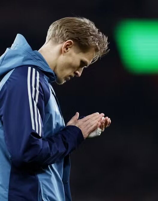 Meia do Arsenal admite pressão pelo título após derrota no clássico